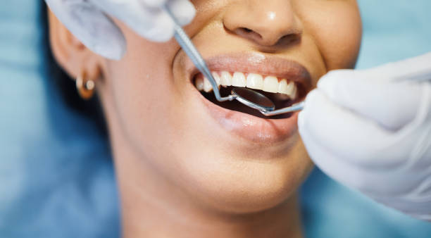 Best Knocked-Out Tooth Emergency  in Exeter, CA