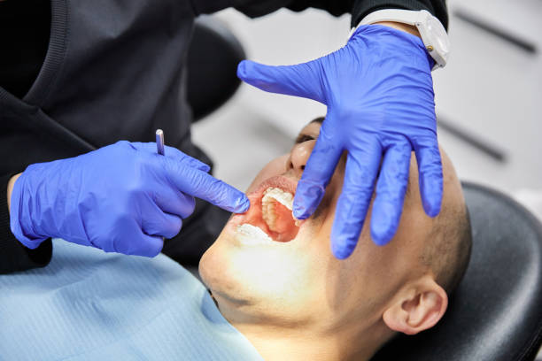 Best Urgent Tooth Repair  in Exeter, CA